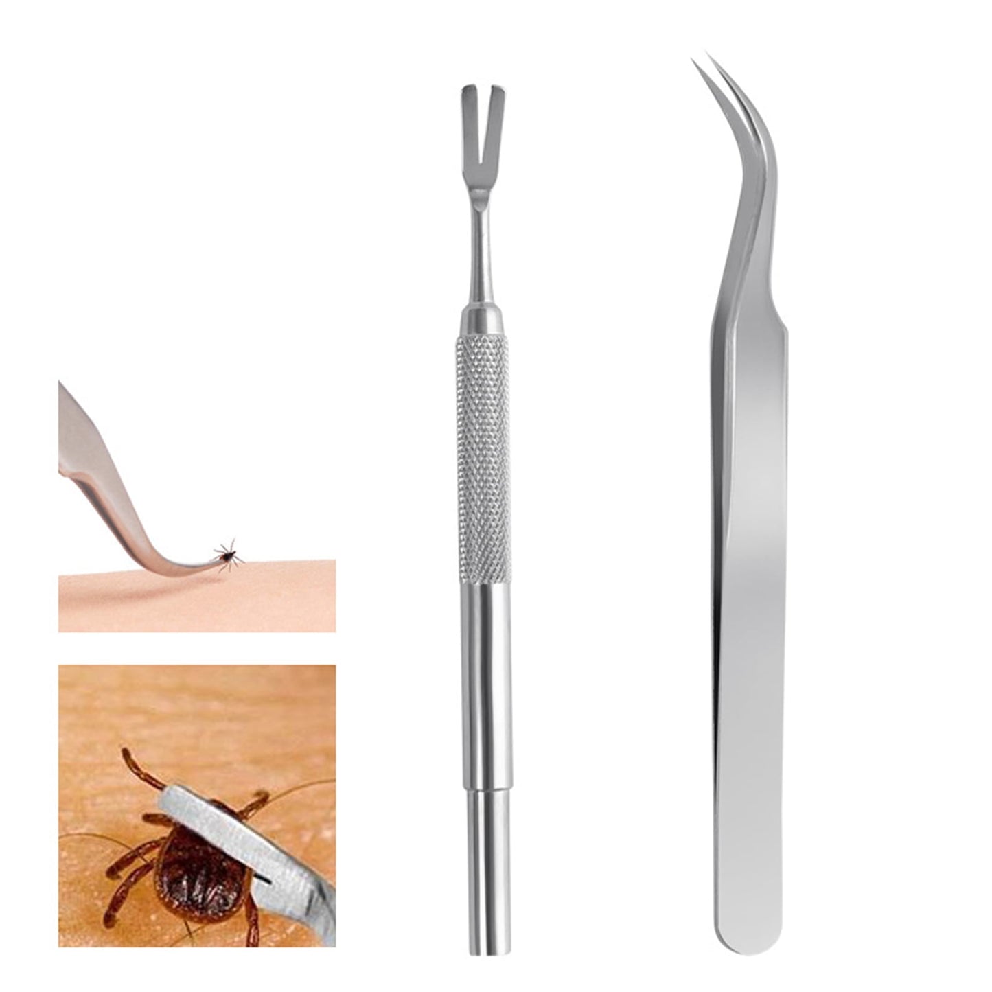 Cheers.US 1 Set Tick Remover Tool Set Stainless Steel Tick Remover Kit for Cats and Dogs Grooming Supplies for Puppy
