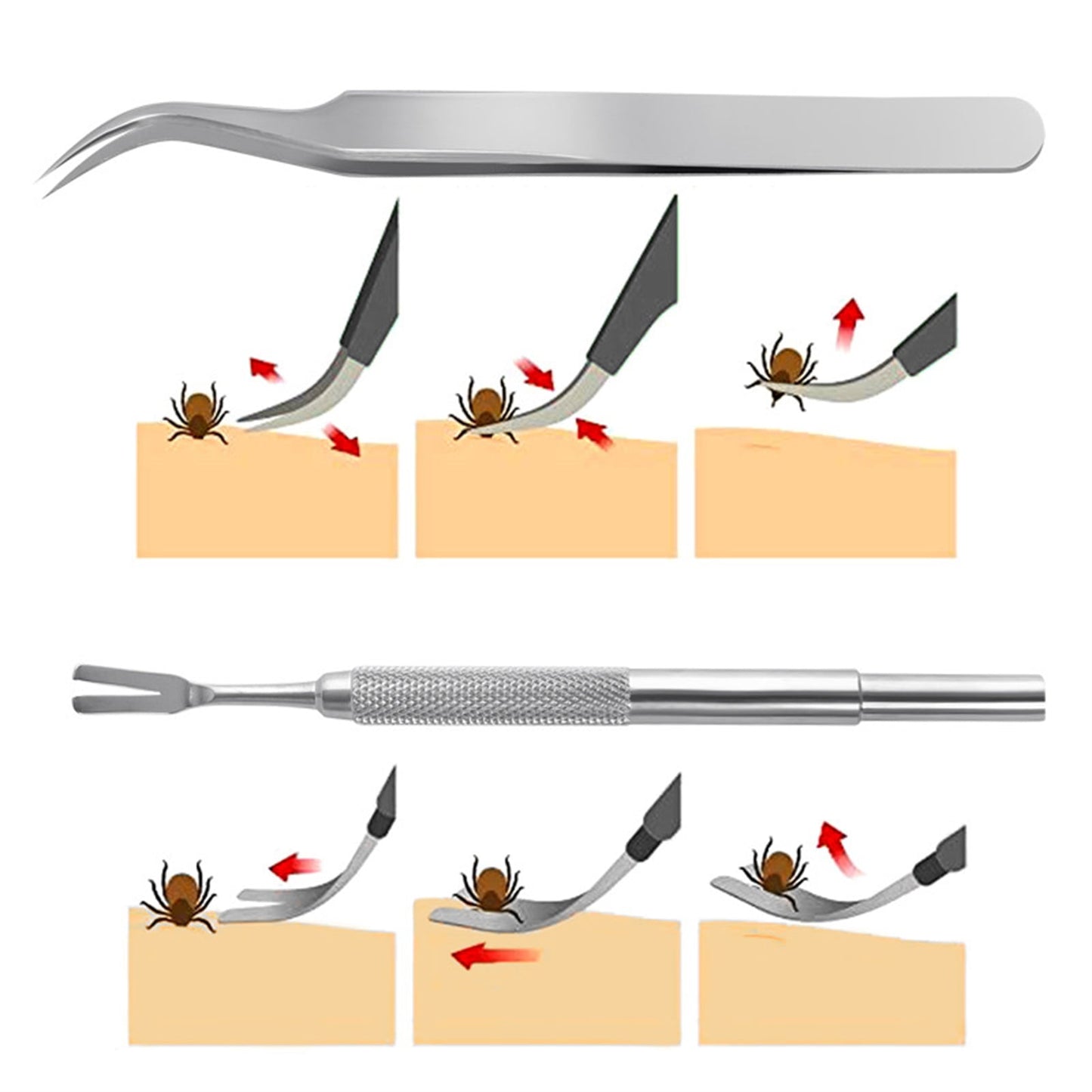 Cheers.US 1 Set Tick Remover Tool Set Stainless Steel Tick Remover Kit for Cats and Dogs Grooming Supplies for Puppy