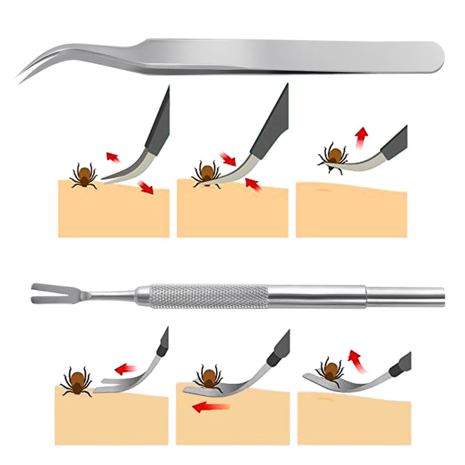 Cheers.US 1 Set Tick Remover Tool Set Stainless Steel Tick Remover Kit for Cats and Dogs Grooming Supplies for Puppy